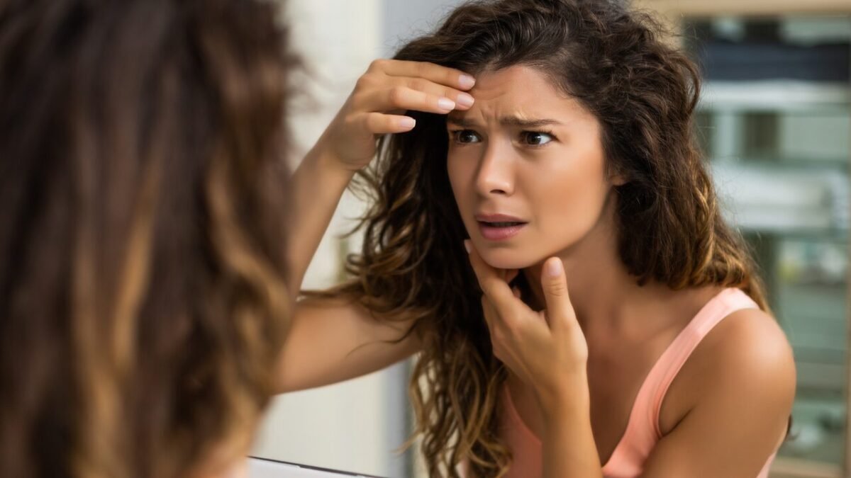 Como Reduzir Linhas de Expressão com Cuidados Diários 1 1 26 14