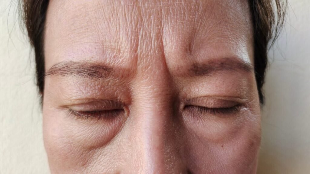 Como Reduzir Linhas de Expressão com Cuidados Diários 2 2 27 16