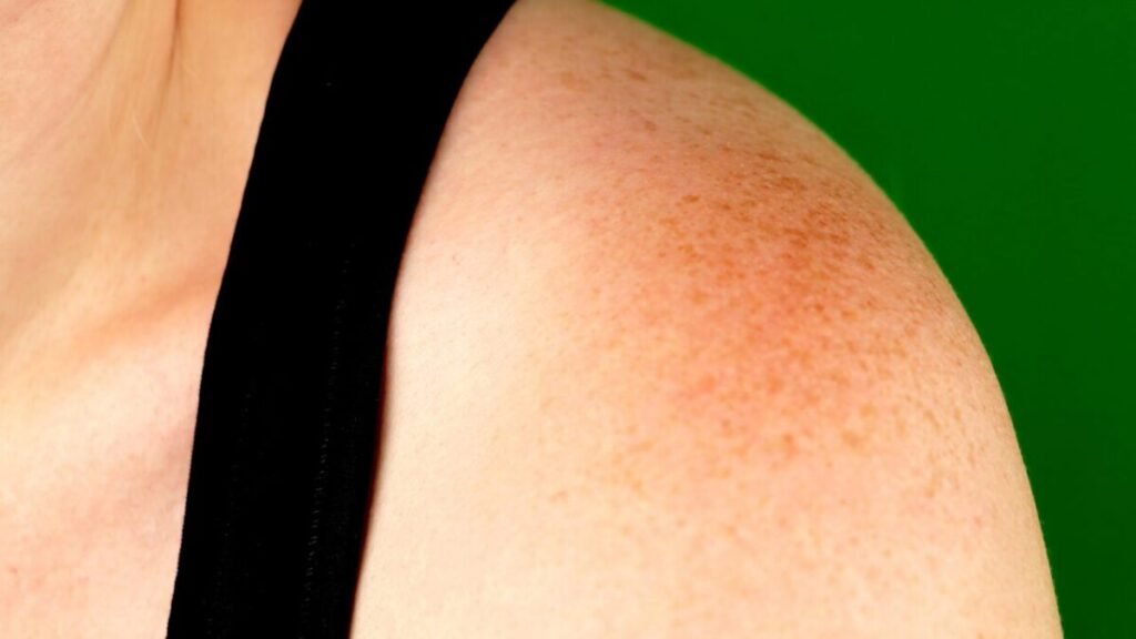 OS MELHORES INGREDIENTES PARA CLAREAR MANCHAS NA PELE 2 2 27 3